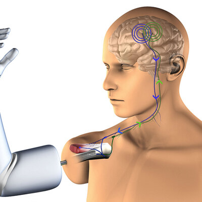 Timeline: Historia de los Biomateriales