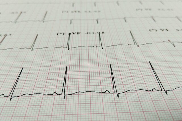 Invención del Electrocardiograma