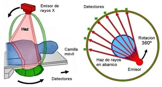 Aplicación práctica de los resultados de Radón
