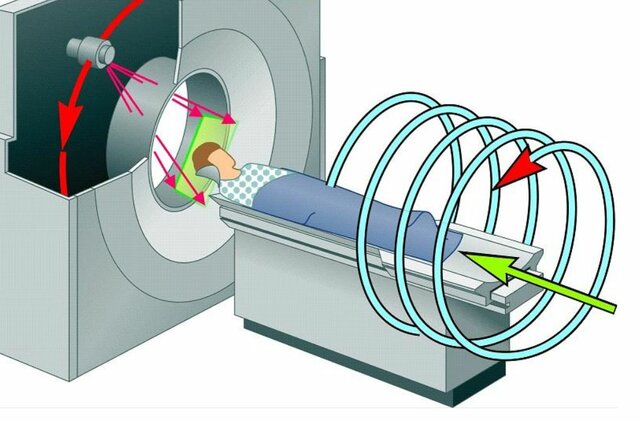 Tomografía computada Helicoidal
