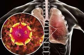 LA OMS emite un alerta global por el síndrome respiratorio agudo severo (SARS)