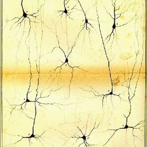 Camillo Golgi "reazione nera"