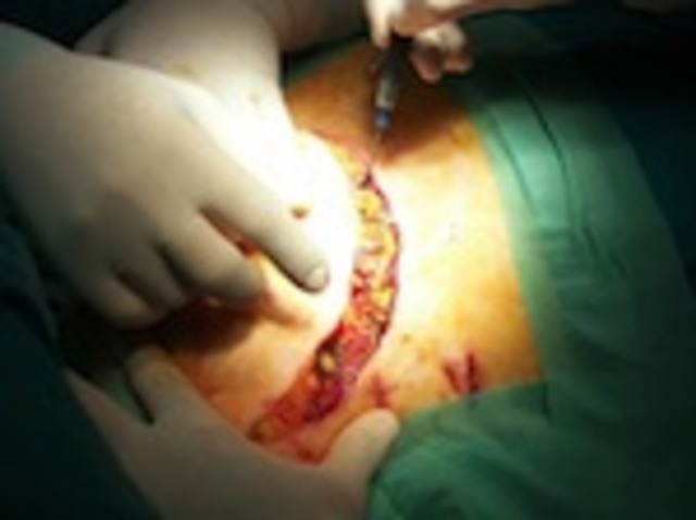 11:15P: Dr. Zairis arrives at Hospital