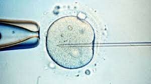 Primer Nacimiento tras Fecundación IN-Vitro