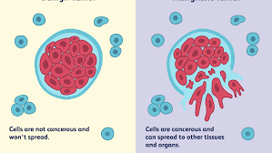 Malignant Cells form