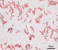 Tinción de Schaefer Fulton
