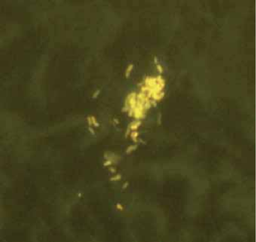 Tinción Rodamina-Auramina.