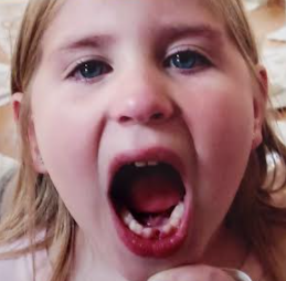 Lost my first tooth