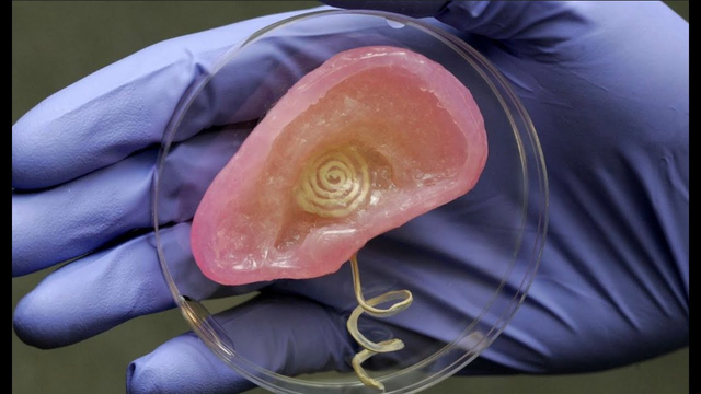 ¡¿IMPRESION DE ORGANOS?!