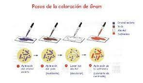Tinción de Gram