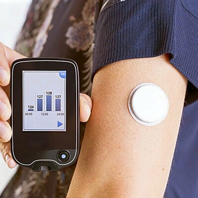 Timeline: Blood Glucose Monitoring