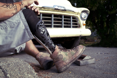 Implante en los humanos de los primeros órganos modificados por medio de implantes arteriales impresos en 3D y cubiertos con células del paciente