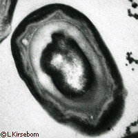 El proceso de esporulación en Mycobacterium