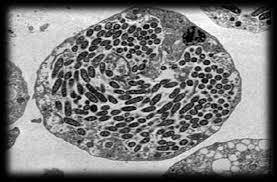 Secuenciación del genoma de Legionella pneumophila