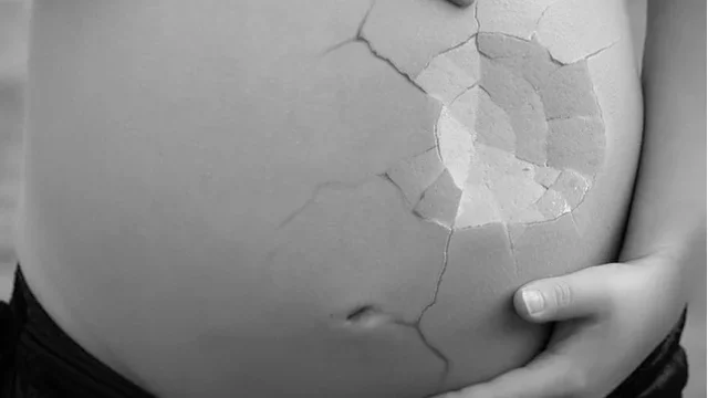 Sentencia T -009 de 2009