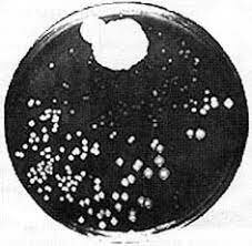 DESCUBRIMIENTO DE LA PENICILINA
