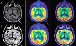 Imágenes diagnósticas