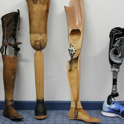 Timeline: The Evolution of Orthotic and Prosthetic (O&P) Practitioners