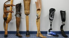 Timeline: The Evolution of Orthotic and Prosthetic (O&P) Practitioners