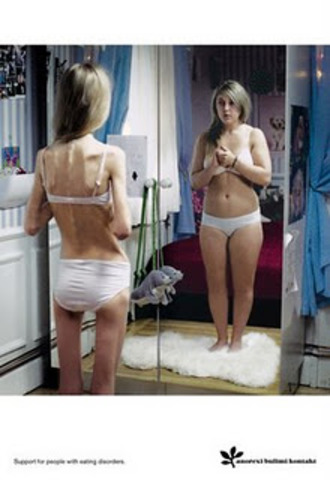 Primer caso de anorexia