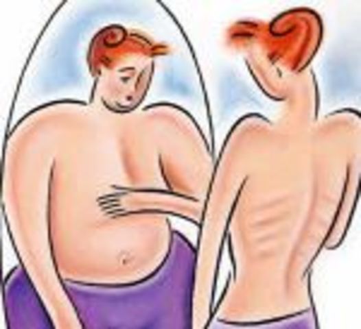 Primera descripcion de anorexia