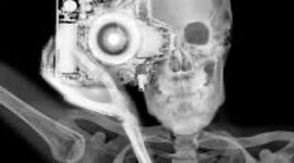 Timeline: Radiologic Technologist