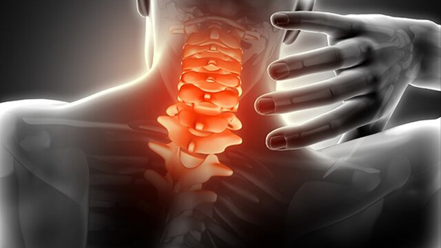 Accidente que cambio su vida