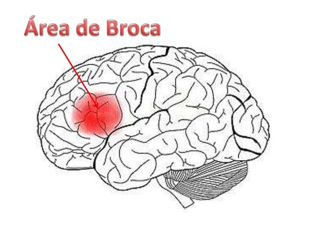 Broca