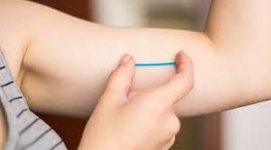 Creación de Implantes Subdermicos