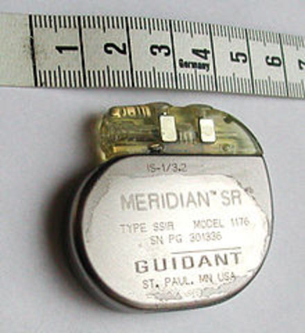 The first Cardiac Pacemaker