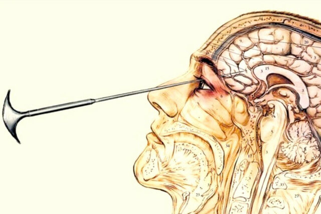 M. Rueda introduce métodos modernos de terapia