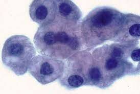 Patologia celular - Friedrich Günzburg y  Robert Remak