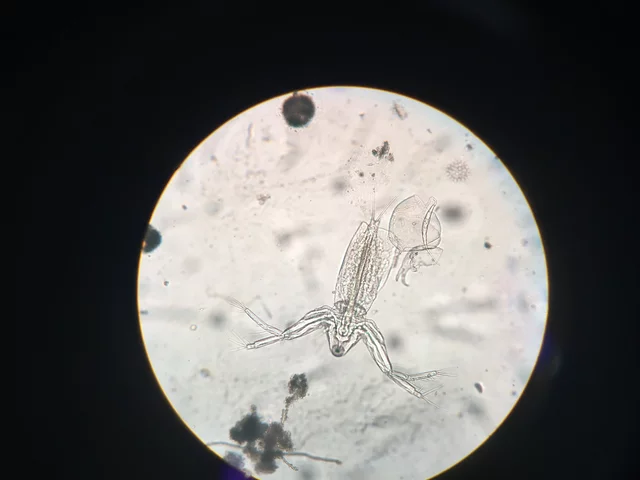 The water microscope