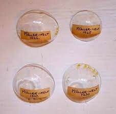 F.E. Muller, who created the very first contact lenses.