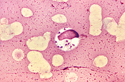 Leishmania panamensis \Se crea Cenics