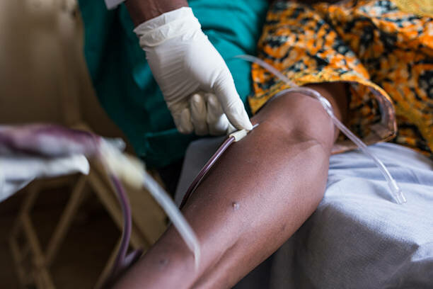 La epidemia del ébola