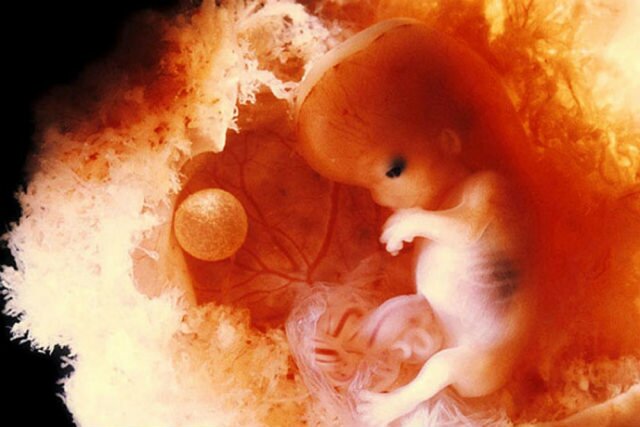 Apreciación del feto