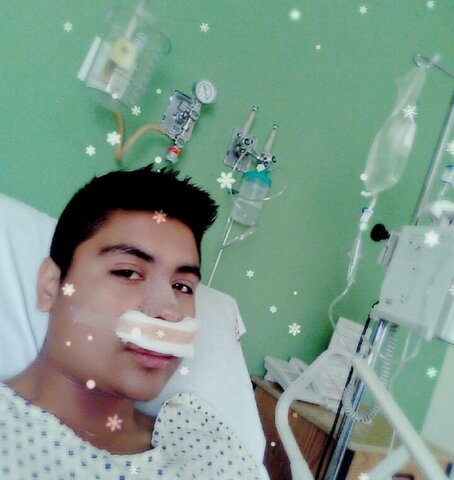 Operacion de tabique