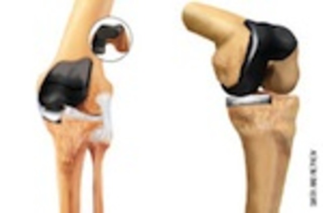 Comparison Study performed in England