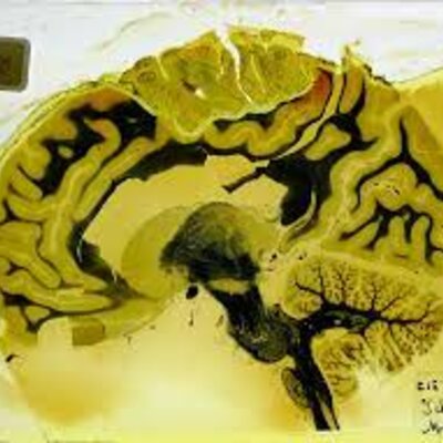 Timeline: Hitos Históricos  de la Discapacidad hasta Colombia