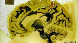 Timeline: Hitos Históricos  de la Discapacidad hasta Colombia