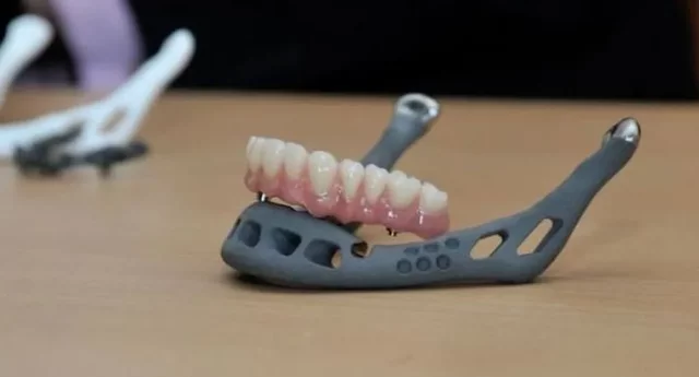 Trasplantan mandíbula hecha en impresora 3D