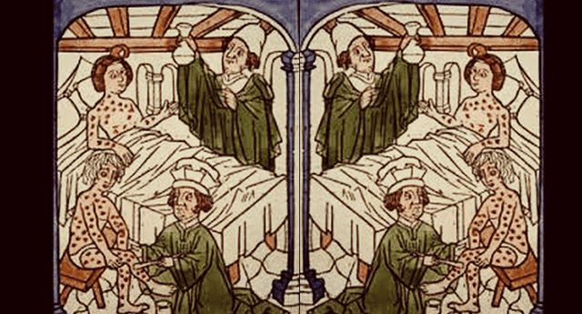 EDAD MODERNA: La Sífilis