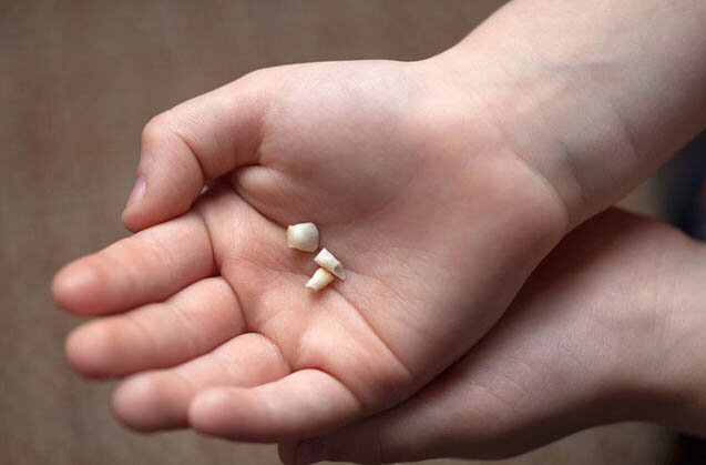 Primera dent que s'hem cau