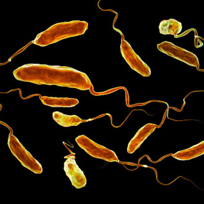 Timeline: VIDRIO CHOLERAE