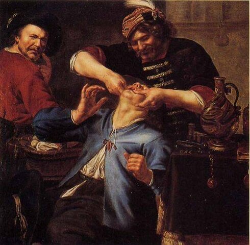 Extracción dentaría