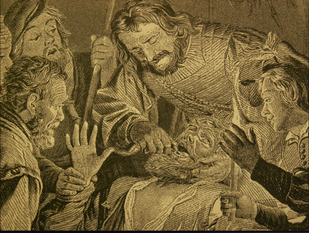 Ranuración o mutilación dental