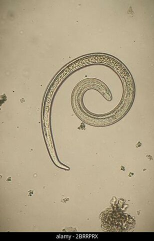 Triquinella espiralis
