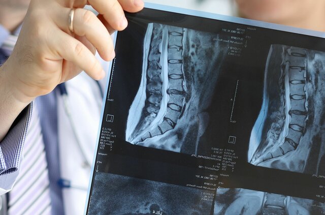 Aplicacion de isotopos en la medicina