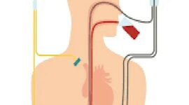 Timeline: Evolución de la Nutrición Enteral y parenteral